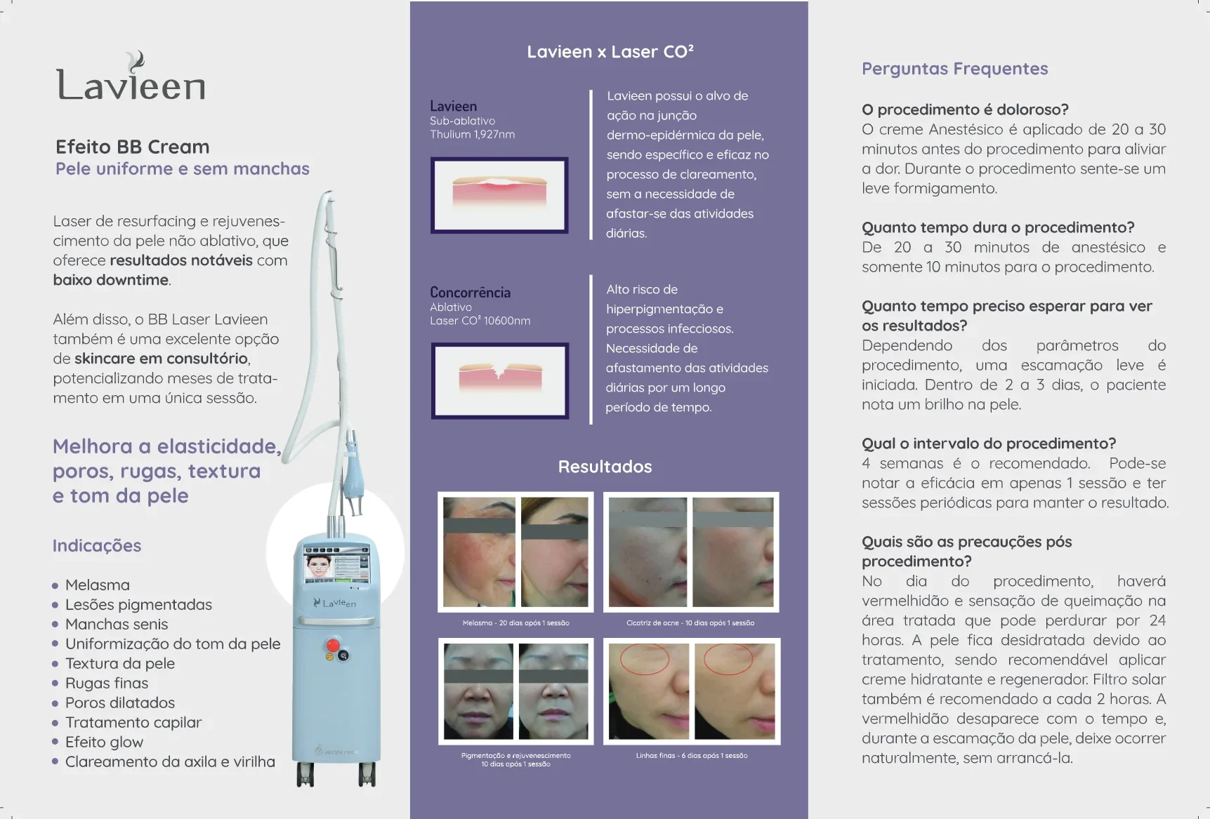 Folder do Lavieen, verso: indicações, Lavieen x laser CO2, resultados e perguntas frequentes